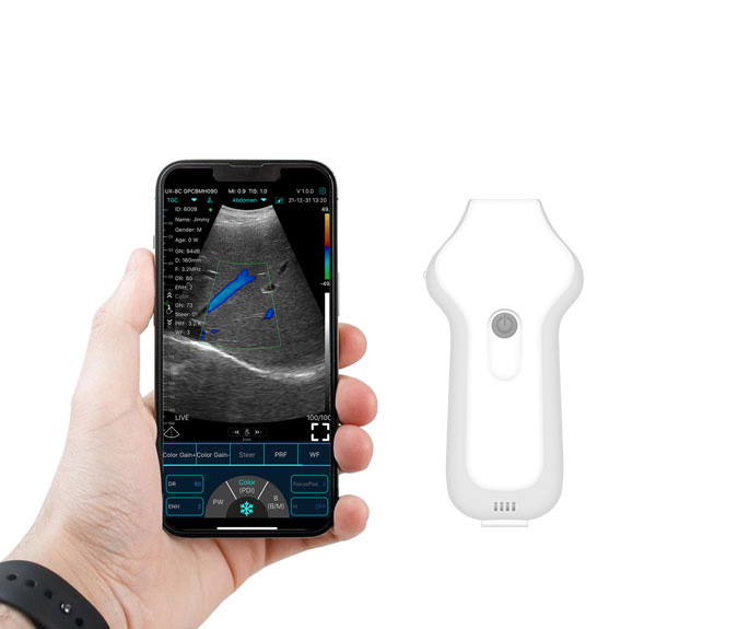 Aplicação de Scanners de ultra-som sem fio em cirurgia geral