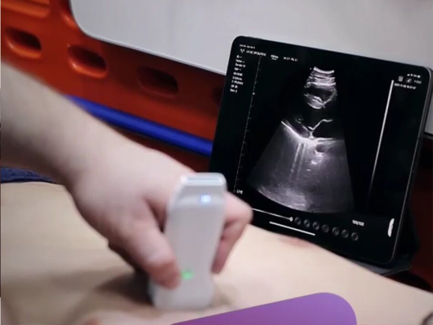 Sonda de ultrassom sem fio usada em cardiologia