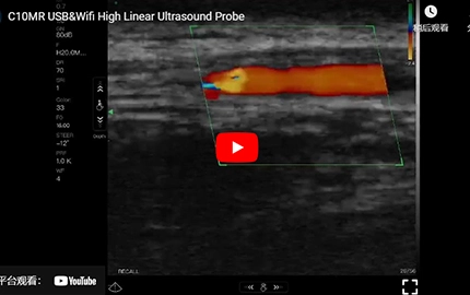 C10MR USB & Wifi Alta Linear Sonda de Ultrassom Demo