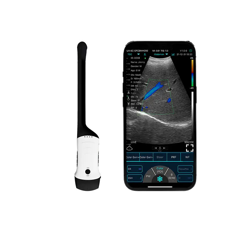 O scanner de ultrassom portátil abre uma nova era no exame médico