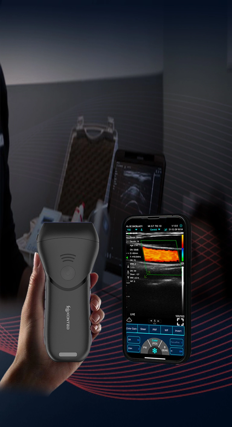 COMECE SUA HANDHELD ULTRASOUND, FÁCIL DE USAR, A QUALQUER MOMENTO, EM QUALQUER LUGAR