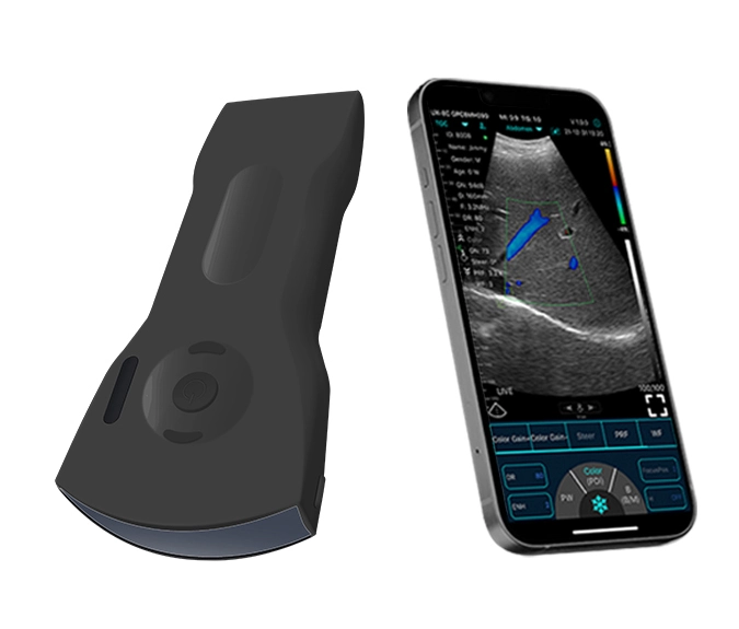 c10xs handheld ultrasound1